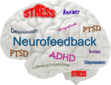 neurofeedback_brain